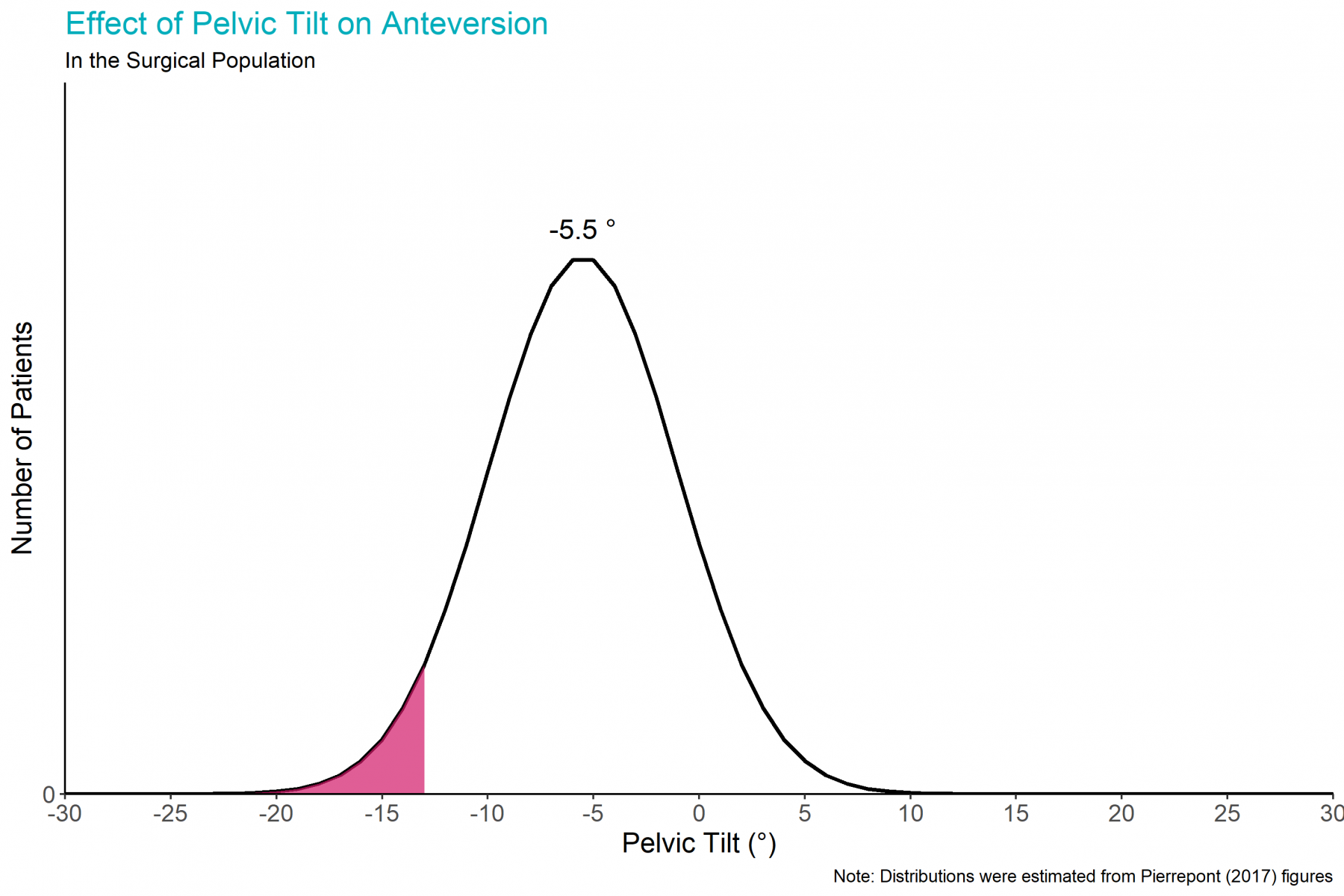 Accommodating Pelvic Tilt When Using Navigation – Navbit