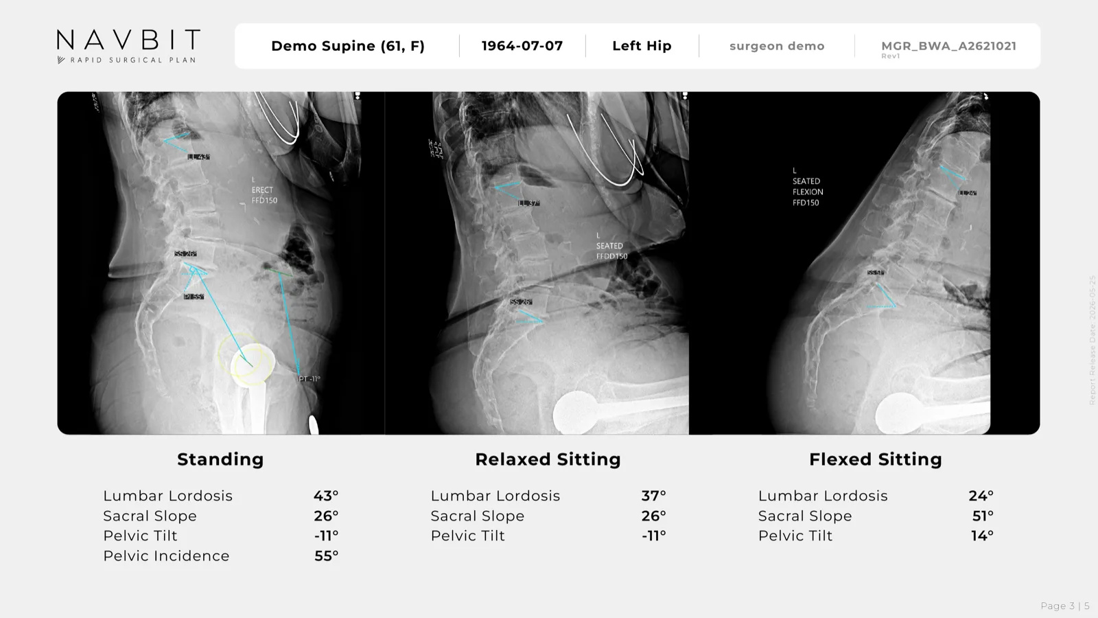 RAPID surgical plan, page 3: lateral radiographs standing, relaxed sitting and flexed sitting with measured angles